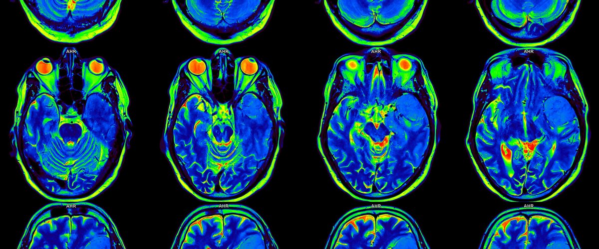 魏茨曼研究所发布 Brain-IT：从脑活动重建所见图像，学习新人只需一小时扫描